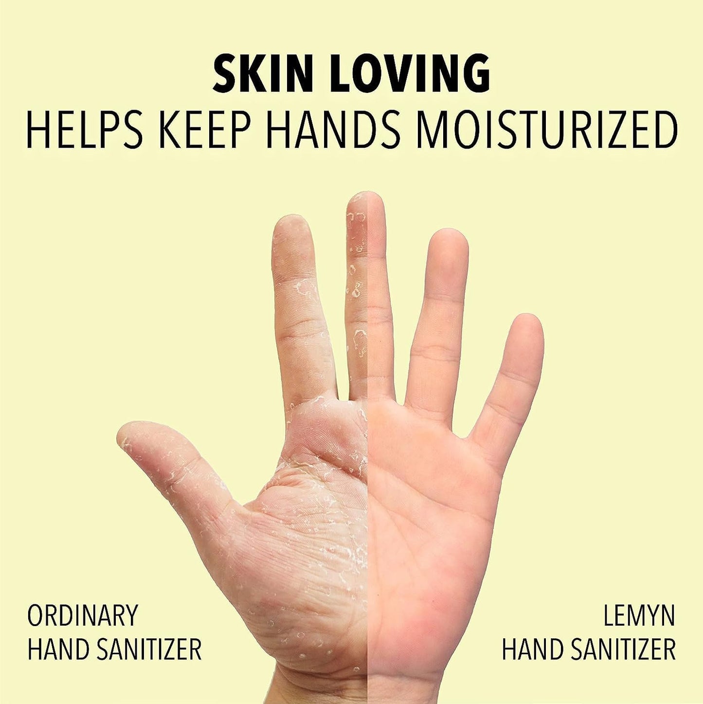 Medical Grade Hand Sanitizer Gel - 97% ORGANIC - 8 FL.OZ. Flip-Top (PACK OF 4)